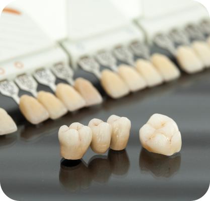 Dental Bridge Solutions 02