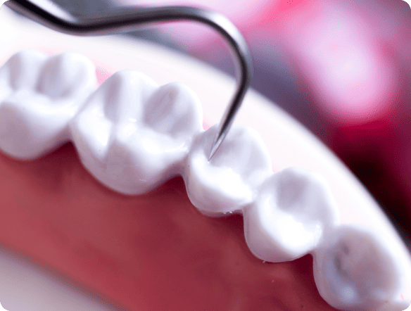 Keep-Your-Dentures-In-Top-Shape