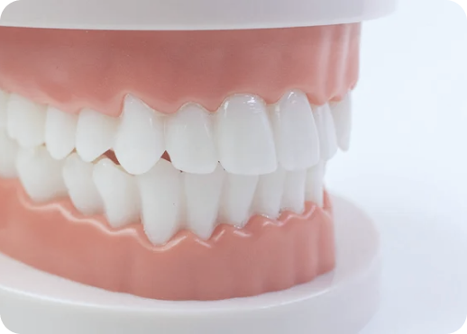 Permanent Denture Reline (1)