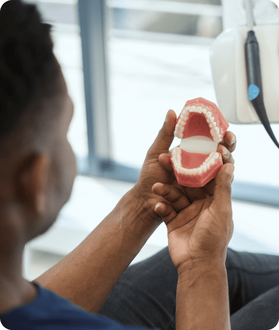 Amalgam Fillings