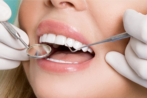 cosmetic-dental-services-card-img03