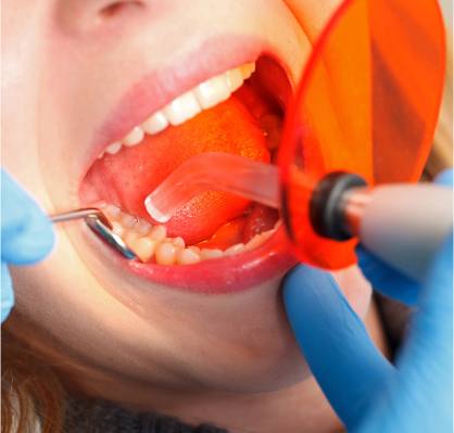 dental-fillings-media-group-img01