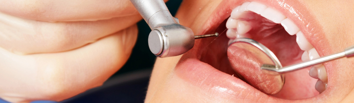 Gum Disease Banner