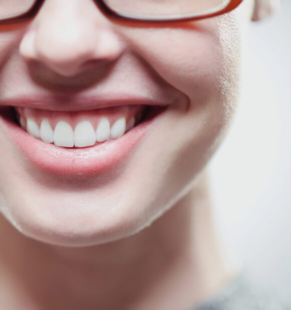 Gummy Smile