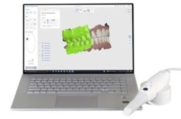 Intraoral Scanning Img