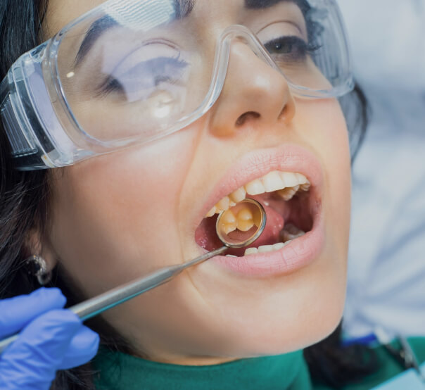 patient-getting-teeth-checked-using-dental-mirror-tool-img