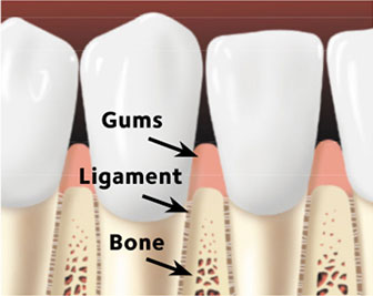 Healthy Gums – No Disease