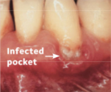 Before Treatment