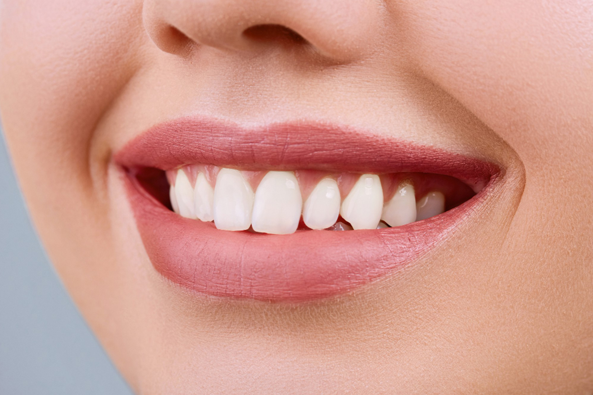 Teeth Whitening: What You Need To Know Before You Start