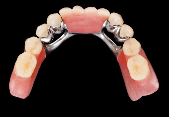 The Ultimate Guide To Dentures: Types And Benefits