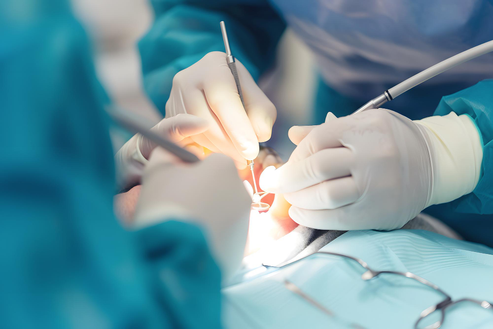 X Types Of Oral Surgery Procedures And Their Benefits